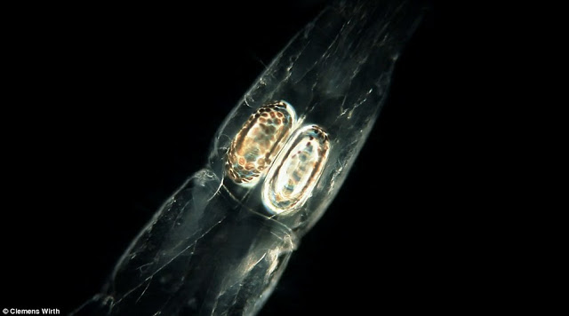 Αυτά τα τέρατα είναι μέσα στο νερό που πίνουμε-Σοκάρουν οι φωτογραφίες από μικροσκόπιο - Φωτογραφία 5