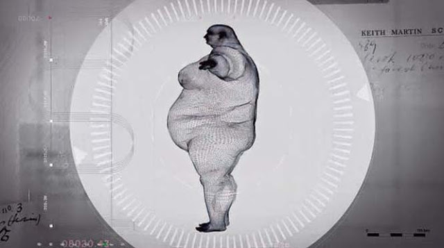 Εικόνες που προκαλούν ΣΟΚ! Δείτε πως είναι οι ακτινογραφίες ενός ανθρώπου 445 κιλών [photos + video] - Φωτογραφία 2