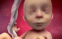 Αγόρι ή κορίτσι; Δείτε το ΣΥΓΚΛΟΝΙΣΤΙΚΟ βίντεο για το πώς διαμορφώνεται το φύλο του μωρού στη μήτρα!