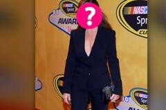 Μα πόσες πλαστικές έκανε; Ποια celebrity εμφανίστηκε με άλλο... πρόσωπο; [photos]
