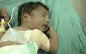 Μωρό με τρία χέρια γεννήθηκε στην Ινδία - Φωτογραφία 1