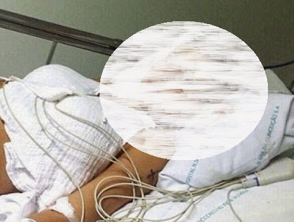 ΠΡΟΣΟΧΗ ΣΚΛΗΡΗ Εικόνα στο νοσοκομείο: Από πλαστική μοντέλο κινδύνευσε να χάσει το πόδι της! [photo] - Φωτογραφία 1