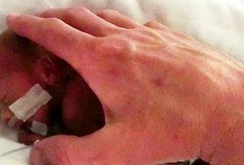 Η ιστορία που ΡΑΓΙΖΕΙ ΚΑΡΔΙΕΣ: Οι γιατροί την πίεζαν τα ρίξει το παιδί της επειδή γεννήθηκε πρόωρα και δεν τους άκουσε...[photos] - Φωτογραφία 1