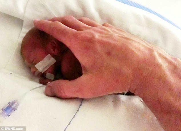 Η ιστορία που ΡΑΓΙΖΕΙ ΚΑΡΔΙΕΣ: Οι γιατροί την πίεζαν τα ρίξει το παιδί της επειδή γεννήθηκε πρόωρα και δεν τους άκουσε...[photos] - Φωτογραφία 7