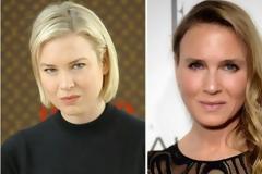 Renee Zellweger: Με άλλο πρόσωπο ξανά η ηθοποιός! [photos]