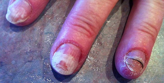 Σοκαριστικό: Τα νύχια αυτής της γυναίκας ΚΑΤΑΣΤΡΑΦΗΚΑΝ με κάτι που κάνουν όλες οι γυναίκες [photo] - Φωτογραφία 2