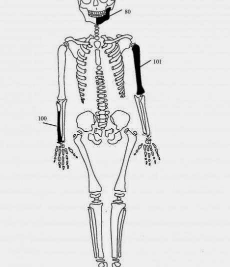 Πέντε οι σκελετοί της Αμφίπολης - Δείτε φωτο - Φωτογραφία 8