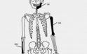Πέντε οι σκελετοί της Αμφίπολης - Δείτε φωτο - Φωτογραφία 8
