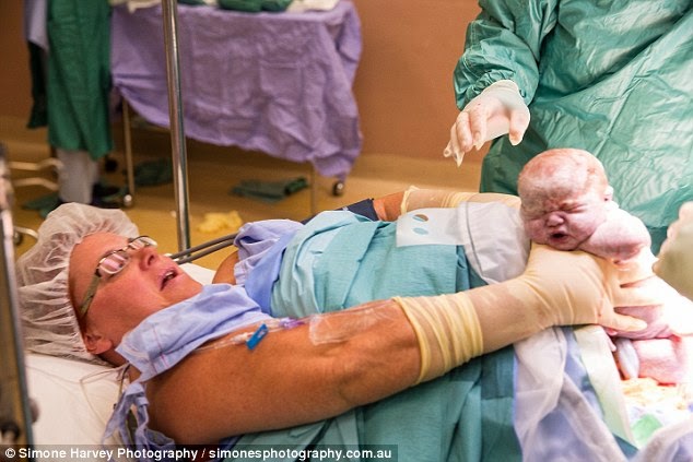 Έβγαλε τα δίδυμα μωρά της από την κοιλιά της…με τα χέρια της - Φωτογραφία 3