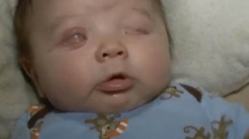 ΠΡΟΣΟΧΗ ΣΚΛΗΡΕΣ ΕΙΚΟΝΕΣ: Μωράκι γεννήθηκε χωρίς μάτια! [photos] - Φωτογραφία 2