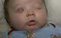 ΠΡΟΣΟΧΗ ΣΚΛΗΡΕΣ ΕΙΚΟΝΕΣ: Μωράκι γεννήθηκε χωρίς μάτια! [photos] - Φωτογραφία 2