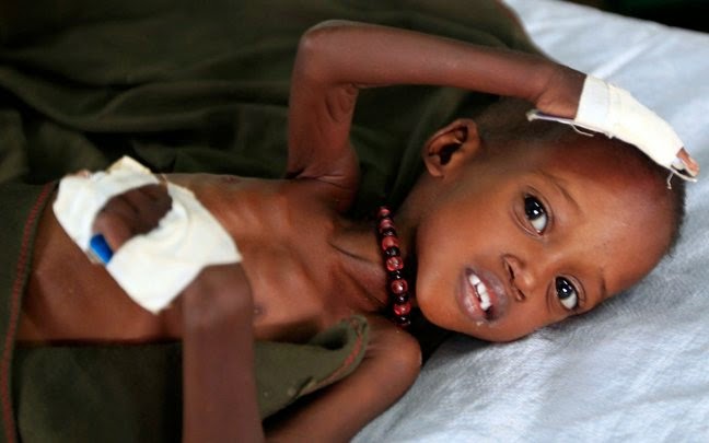 Πεθαίνουν από την πείνα τα παιδιά στη Σομαλία - Φωτογραφία 1