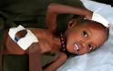 Πεθαίνουν από την πείνα τα παιδιά στη Σομαλία