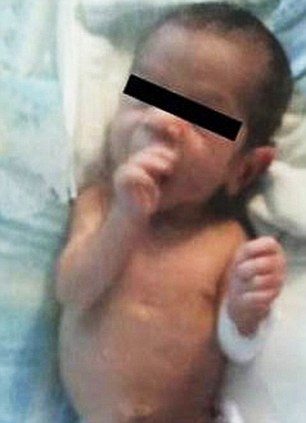 ΠΡΟΣΟΧΗ ΣΚΛΗΡΕΣ ΕΙΚΟΝΕΣ: Νεογέννητο μωράκι σε άθλια κατάσταση...Δείτε τι του έκανε η ίδια του η μητέρα! [photos] - Φωτογραφία 5