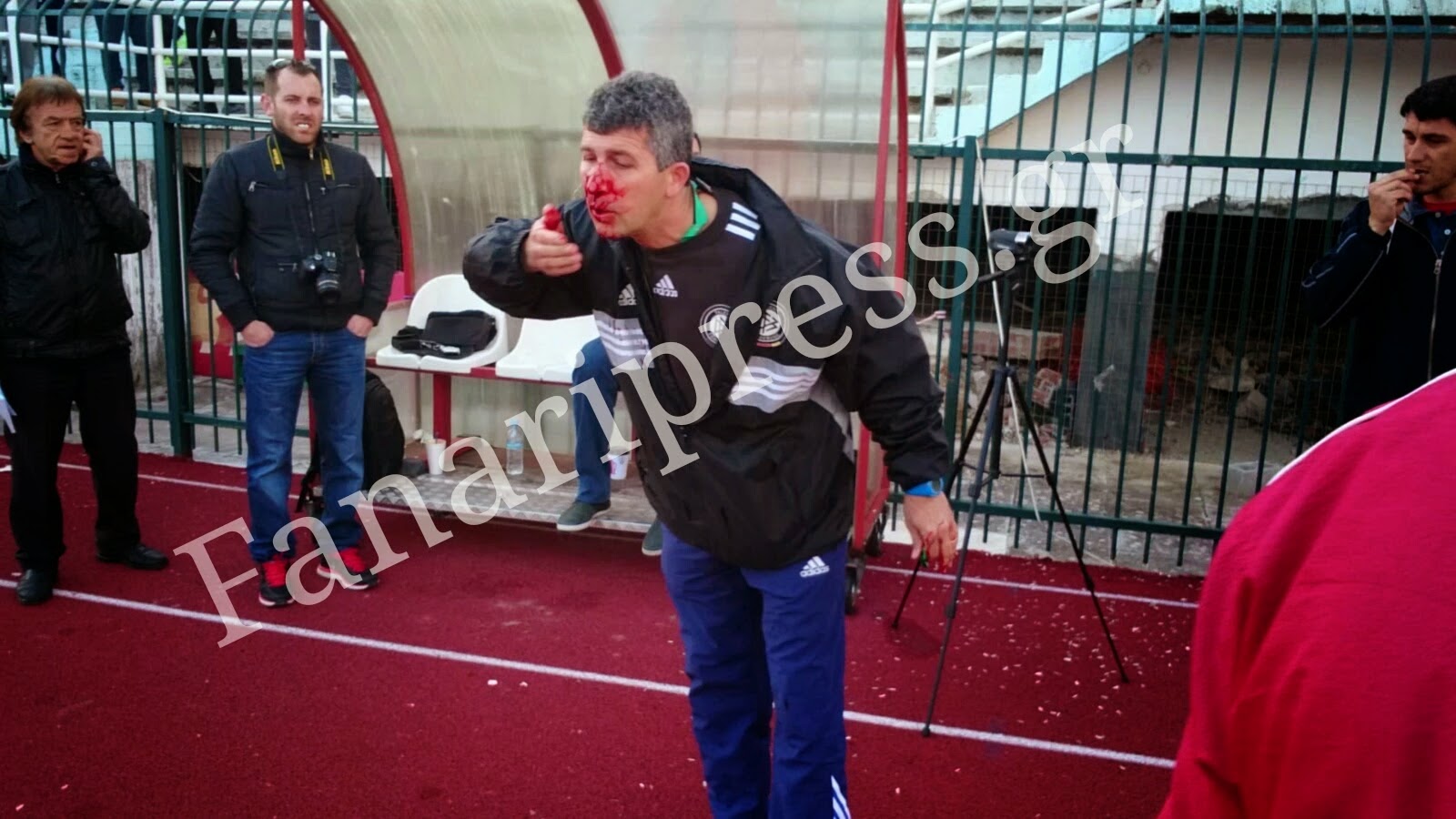 Σοκάρουν οι φωτογραφίες από την επίθεση που δέχτηκε από την κερκίδα του Πανλευκάδιου ο βοηθός προπονητή του Πας Αχέρων Καναλακίου - Φωτογραφία 3