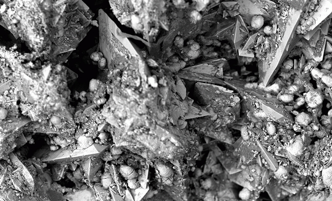 Έτσι μοιάζουν οι πέτρες στα νεφρά κάτω από το μικροσκόπιο - Φωτογραφία 4