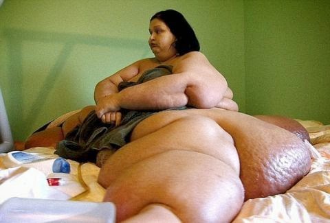Την θυμάστε αυτή τη γυναίκα; Έχασε 362 κιλά! Δείτε πως είναι σήμερα και δεν θα πιστεύετε στα μάτια σας! [photo+video] - Φωτογραφία 1