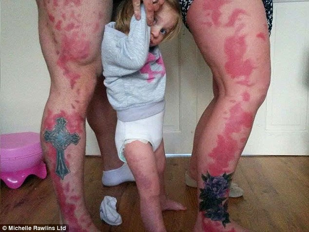 Έκαναν τατουάζ τα σημάδια της κόρης τους - Φωτογραφία 2