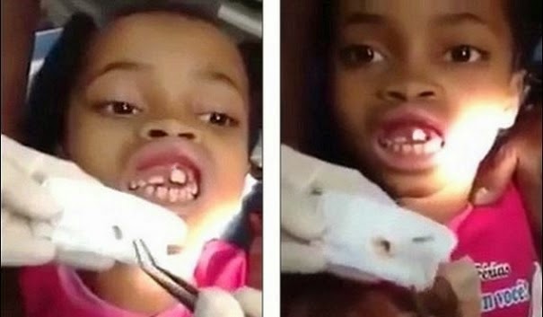 Οδοντίατρος δεν πίστευε στα μάτια του με αυτό που είδε στα ούλα 10χρονης... [video] - Φωτογραφία 1