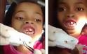 Οδοντίατρος δεν πίστευε στα μάτια του με αυτό που είδε στα ούλα 10χρονης... [video]
