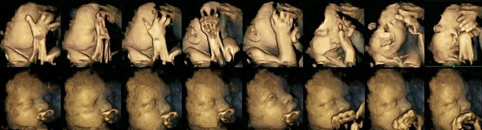Τι κάνει το κάπνισμα σε ένα έμβρυο - Φωτογραφία 2