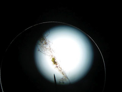 Δείτε σε μικροσκόπιο τι ψεκάζουν τα αεροπλάνα - Φωτογραφία 3