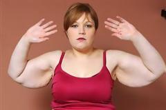 «Σώστε με από το... δέρμα μου!»