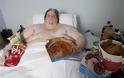 Keith Martin: Ο πιο παχύσαρκος άνθρωπος του κόσμου