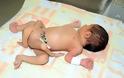 Γεννήθηκε παιδάκι με 6 πόδια αποτέλεσμα αιμομιξίας - Φωτογραφία 3
