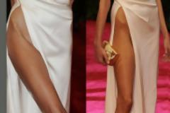 Διάσημο μοντέλο στα όρια της νευρικής ανορεξίας! [φωτό]