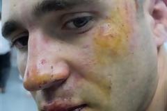 ΔΕΙΤΕ: Φωτογραφίες ΣΟΚ από την επίθεση τραμπούκων στον Κ. Μπογδάνο, στα Εξάρχεια