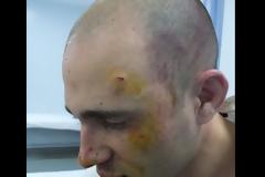 Δόθηκαν στην δημοσιότητα οι φωτογραφίες απο τον ξυλοδαρμό του Μπόγδανου