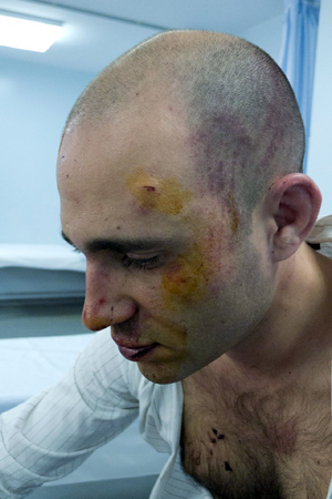 ΣΟΚ: Οι φωτογραφίες του Κ. Μπογδάνου μετά την επίθεση!!! - Φωτογραφία 3