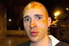 ΣΟΚ: Οι φωτογραφίες του Κ. Μπογδάνου μετά την επίθεση!!!