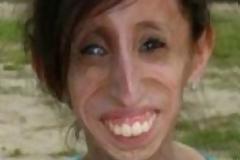 Σοκ: Αυτή η γυναίκα πρέπει να τρώει κάθε 15 λεπτά! [pics]