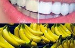 ΑΠΙΣΤΕΥΤΟ - Πως θα λευκάνετε τα δόντια σας με μια μπανάνα; [video] - Φωτογραφία 1