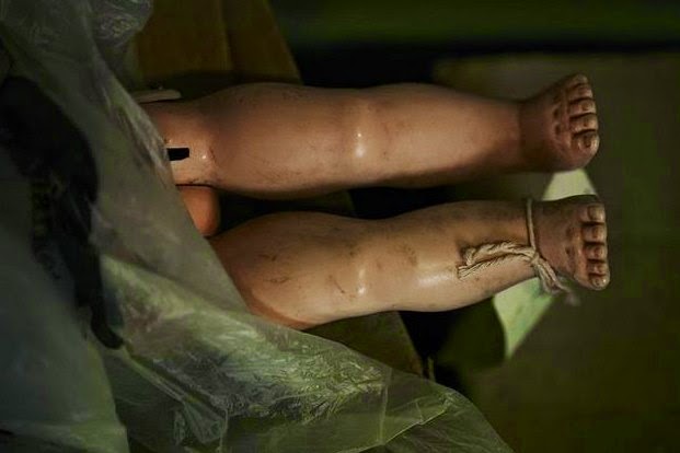 Αυτό είναι το πιο ανατριχιαστικό νοσοκομείο για κούκλες στον πλανήτη... [photos] - Φωτογραφία 1