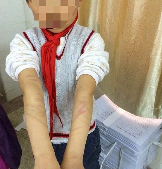 Σοκαριστικές εικόνες - Θετή μητέρα μαστίγωνα 9χρονο επειδή δεν ήξερε την ιστορία του Πινόκιο... [photos] - Φωτογραφία 4