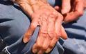 Τραγικό περιστατικό στην Πάτρα: Ανδρας 105 ετών έμεινε νηστικός επί 4 μέρες