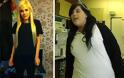 Τραγική ιστορία: Έχασε 120 κιλά και παρακαλεί να τα ξαναπάρει [photos]
