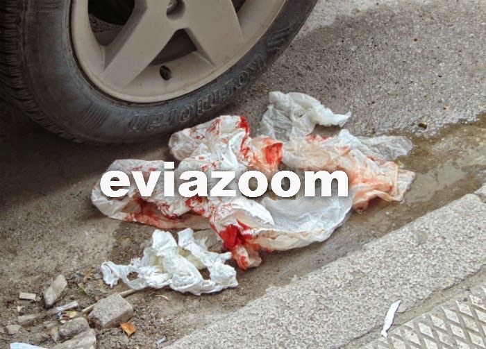 Εύβοια: Αστικό λεωφορείο έκοψε τα δάχτυλα 27χρονης οδηγού που έβγαινε από το αυτοκίνητο - Φωτογραφία 3