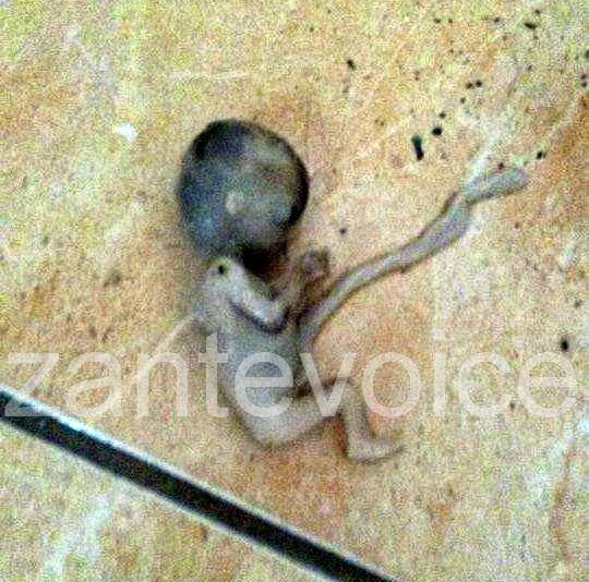 ΣΟΚΑΡΙΣΤΙΚΟ! ΔΕΙΤΕ το έμβρυο που βρέθηκε σε τουαλέτες του ΕΠΑΛ Ζακύνθου... [photos] - Φωτογραφία 3