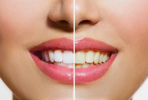Τα καλύτερα tricks για λευκά δόντια - Φωτογραφία 1