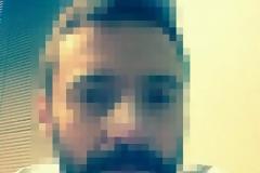Διάσημος ηθοποιός εμφάνισε 4 φορές καρκίνο του δέρματος μέσα σε 18 μήνες [photos]