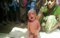 ΣΟΚΑΡΙΣΤΙΚΟ: Δείτε τί έκαναν σε αυτό το 2 ημερών μωράκι στην Ινδία [video]