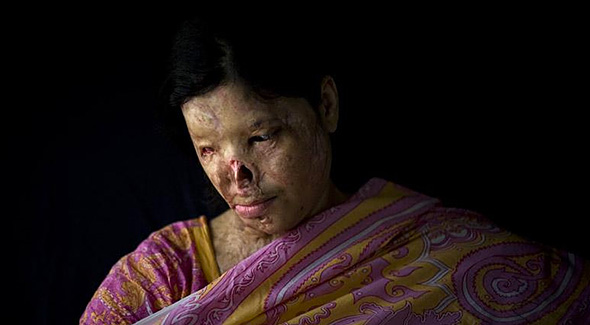 Εικόνες που ΣΟΚΑΡΟΥΝ! Γυναίκες που έπεσαν θύματα ΣΚΛΗΡΗΣ ΒΙΑΣ επειδή...αρνήθηκαν να παντρευτούν [photos] - Φωτογραφία 5