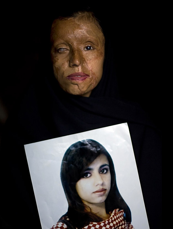 Εικόνες που ΣΟΚΑΡΟΥΝ! Γυναίκες που έπεσαν θύματα ΣΚΛΗΡΗΣ ΒΙΑΣ επειδή...αρνήθηκαν να παντρευτούν [photos] - Φωτογραφία 6
