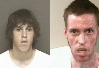 Σοκαριστικές φωτογραφίες ανθρώπων πριν και μετά την χρήση ναρκωτικών ουσιών [photos] - Φωτογραφία 1