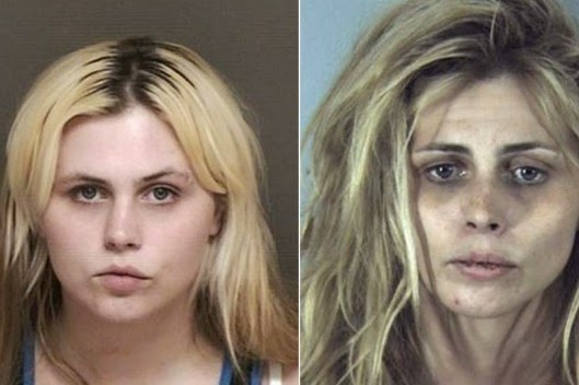 Σοκαριστικές φωτογραφίες ανθρώπων πριν και μετά την χρήση ναρκωτικών ουσιών [photos] - Φωτογραφία 3