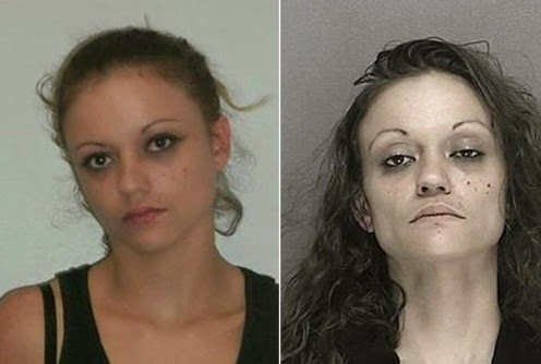 Σοκαριστικές φωτογραφίες ανθρώπων πριν και μετά την χρήση ναρκωτικών ουσιών [photos] - Φωτογραφία 4